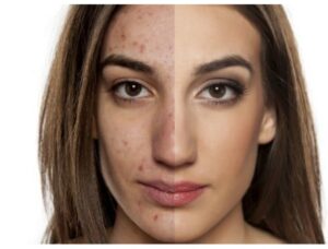 Quality Botox Treatment and Dermatology Services in Irvine, CA